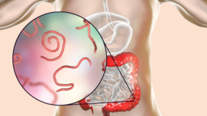 Parasites intestinaux